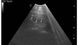 怀孕的黑潭象的脚不那么小，它们正在扫描检查幼崽