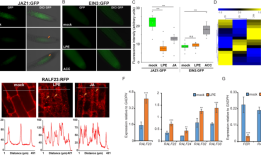 溶磷脂酰乙醇胺通过促进ja信号和ros稳态来触发对坏死细胞的免疫