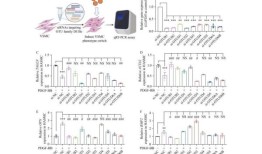 研究：靶向去泛素酶OTUB1通过调节PDGFRβ来保护动脉粥样硬化中的血管平滑肌细胞