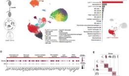 脑-心轴研究发现中风改变免疫系统的表观遗传学
